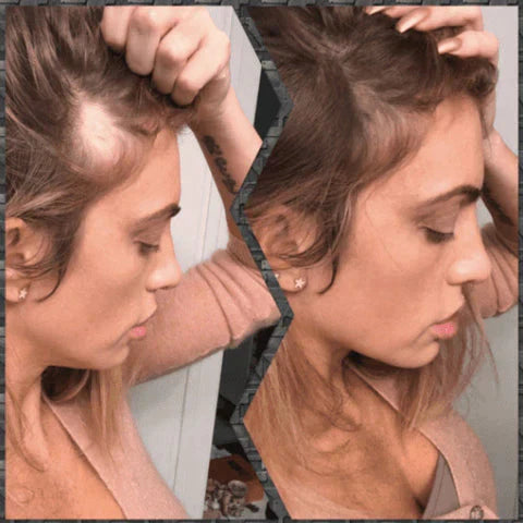 Oferta Única Pague 2 Leve 3 - Preenchimento Capilar Instantâneo HairMAX™